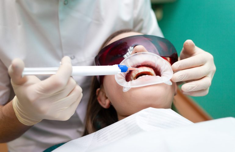 Dentist applies a tooth whitening gel with a syringe. Girl undergoes a teeth whitening procedure in a dental clinic